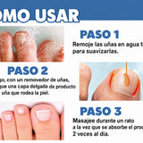 Crema para el tratamiento de hongos en las uñas - additional image 1